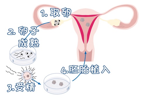 槿棠生殖中心环境